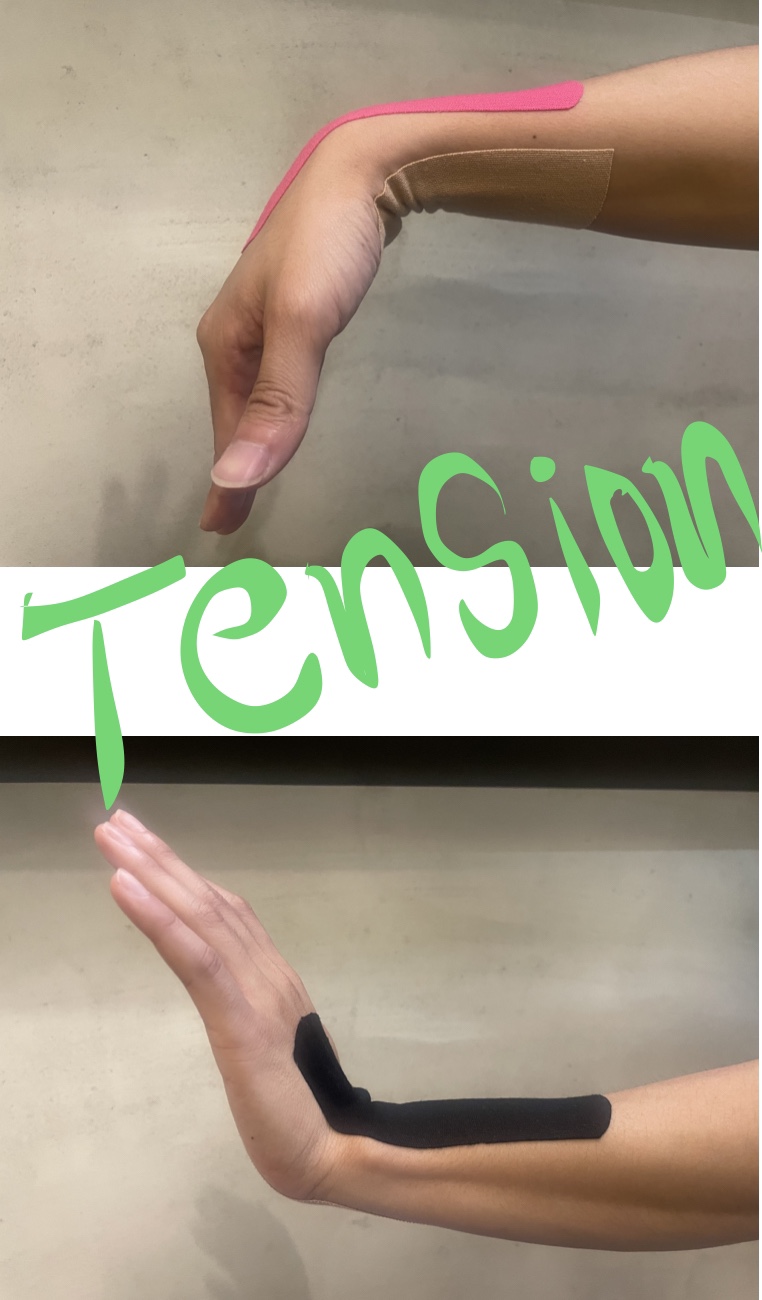 #스포츠테이핑 #손목통증 #텐션