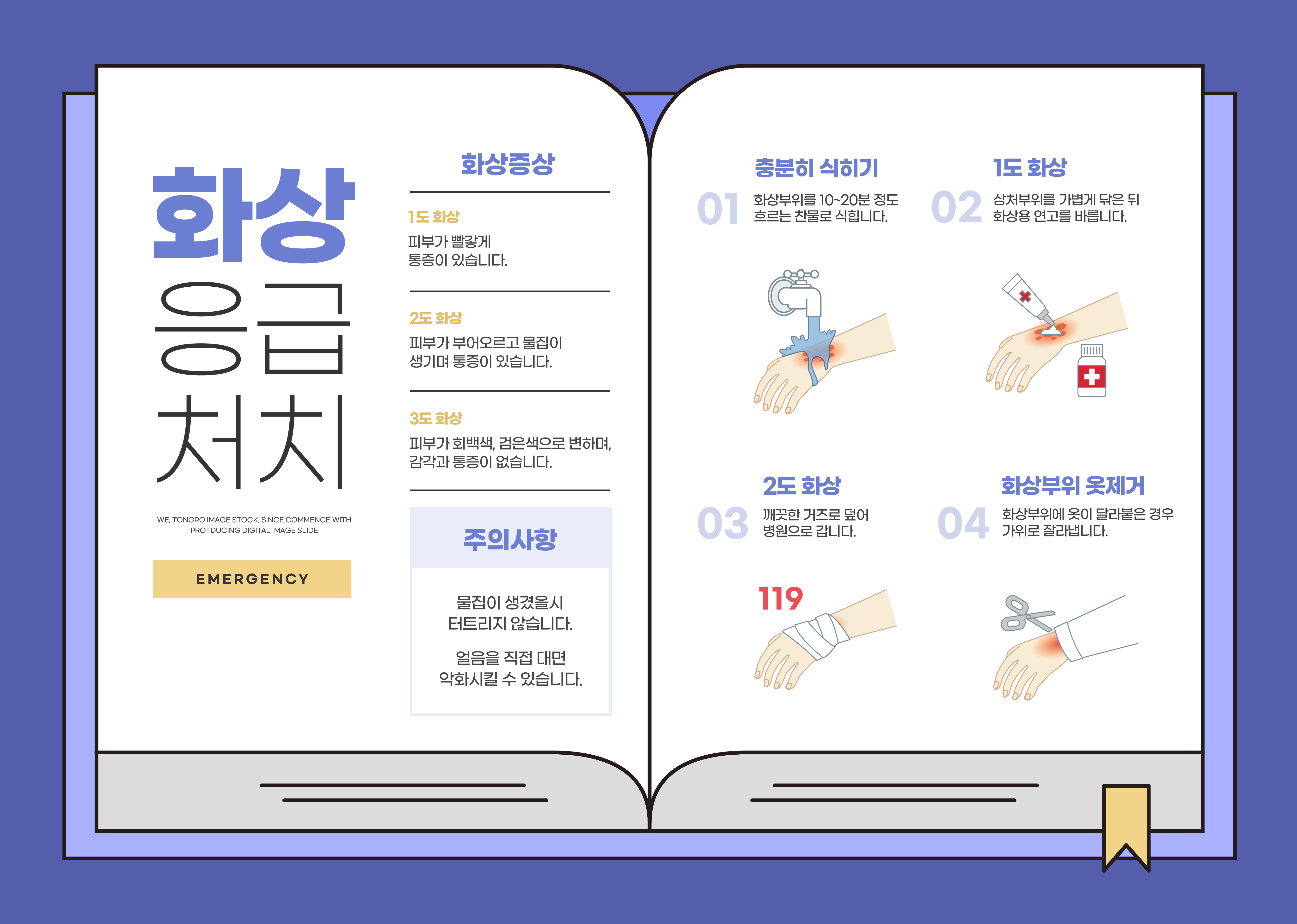 화상 입었을 때 대처방법! 화상종류부터 화상 응급처치 방법까지